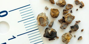 the worst diet for kidney disease